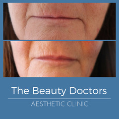 The Beauty Doctors, New Aesthetics Clinic Launching in Sevenoaks! Welcome Dr Rebecca Bradbury