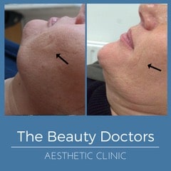 The Beauty Doctors, New Aesthetics Clinic Launching in Sevenoaks! Welcome Dr Rebecca Bradbury