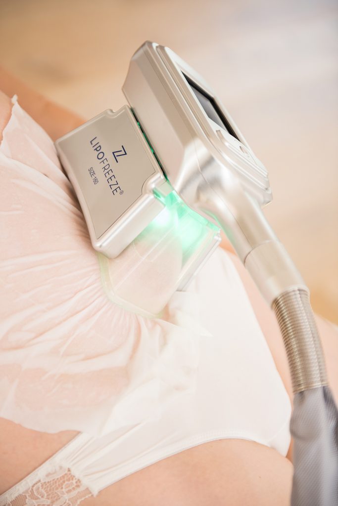 Cryolipolysis at Cryojuvenate