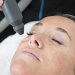 Cryotherapy-Facial