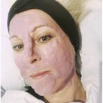 cryotherapy-algae-facial