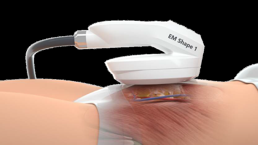 EMS Medisculp Cryojuvenate