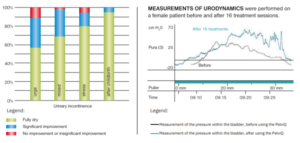 Before and after statistics demonstrating the improvement in the pelvic floor using EMS Medisculp PelvicQthe 