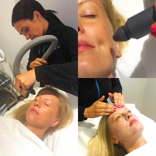 collage of 3 images - close up of cryotherapy on face, face mask and facial massage