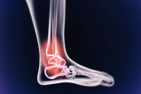 growth related injury ankle