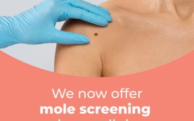 Map my Mole service available in sevenoaks kent