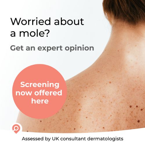 Map My Mole if you are worried about a mole in sevenoaks