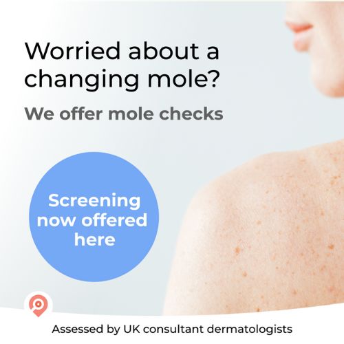 Mole changing colour mole screening Cryojuvenate Sevenoaks