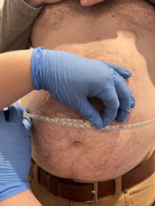Fat Freezing: Everything you need to know about Cryolipolysis in Sevenoaks