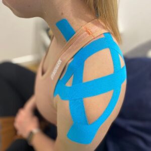 k-taping on shoulder at cryojuvenate sevenoaks