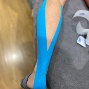 K-Taping for the Calf in Sevenoaks