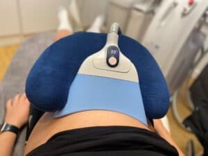 LipoFreeze 360 on the abdomen at Cryojuvenate in Sevenoaks