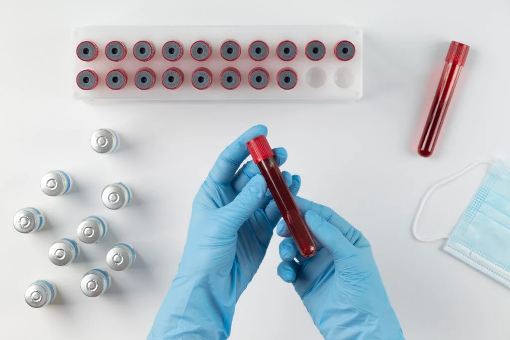 G6PD Deficiency Explained: The Hidden Condition Affecting Millions