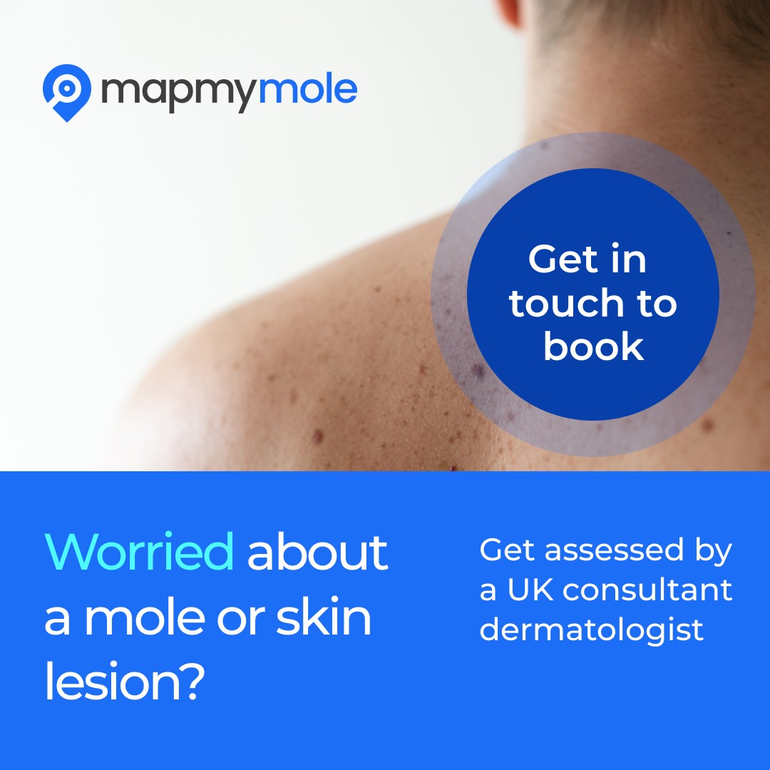 Map my mole Cryojuvenate Sevenoaks
