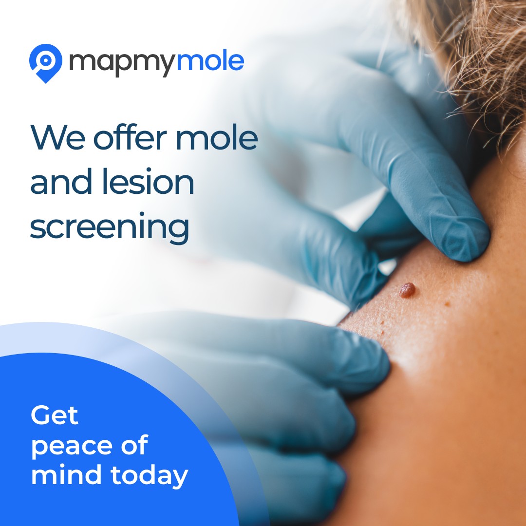 Map My Mole Cryojuvenate Sevenoaks