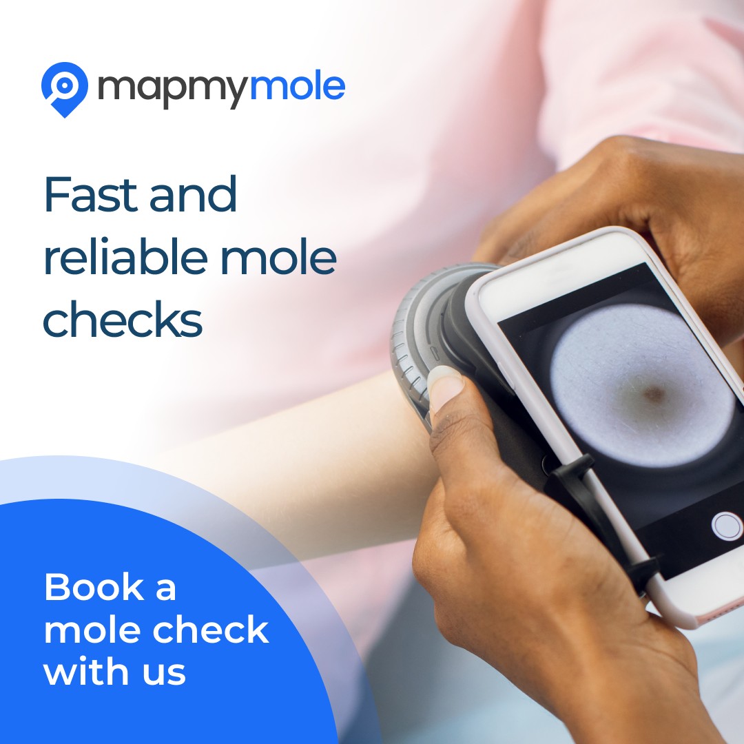 Map My Mole Cryojuvenate Sevenoaks