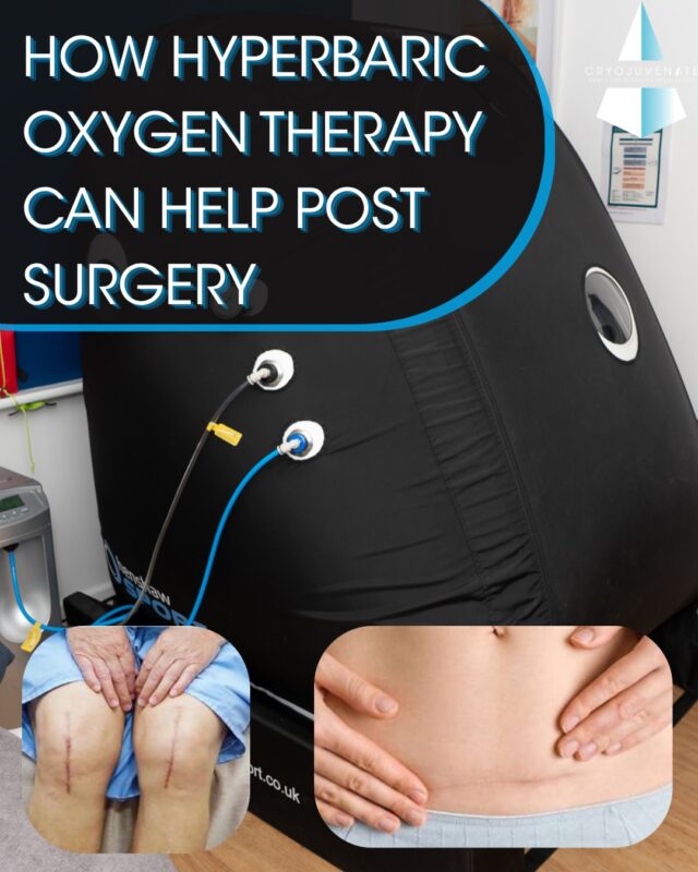 ✨ Recovering after surgery? Give your body the support it needs.

Following surgery, your body needs oxygen, nutrients and good circulation to support the natural healing process. Hyperbaric Oxygen Therapy (HBOT) delivers oxygen under increased pressure, helping to increase oxygen availability to the body’s tissues.

At Cryojuvenate, we’re seeing more clients use HBOT as part of their post-surgery recovery following procedures such as tummy tucks, breast surgery and ACL reconstruction.

HBOT can be used alongside your surgeon’s recommended recovery plan — but it’s important to get medical clearance from your surgical team before starting treatment.

If you’re recovering from surgery and want to find out whether HBOT could be appropriate for you, get in touch with our team at Cryojuvenate. 💙

#cryotherapy #postsurgery #oxygentherapy